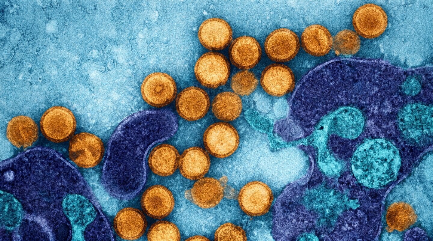 What is hantavirus that killed 3 passengers on cruise ship?