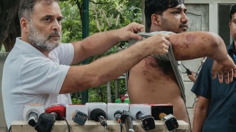 Rahul Gandhi questions 'barbaric assault' in Jantar Mantar protest
