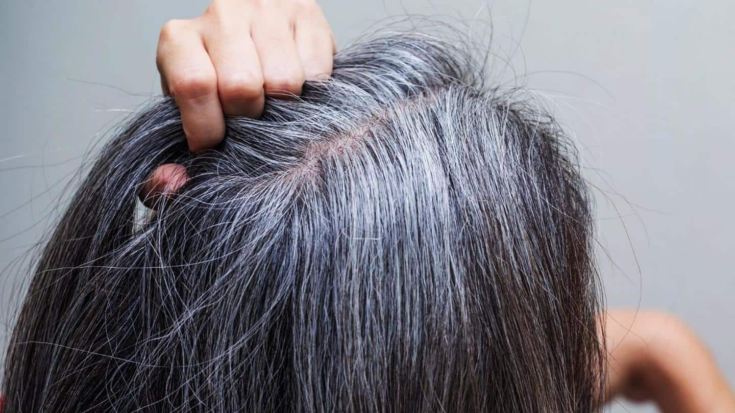 5 natural ways to avoid grey hair