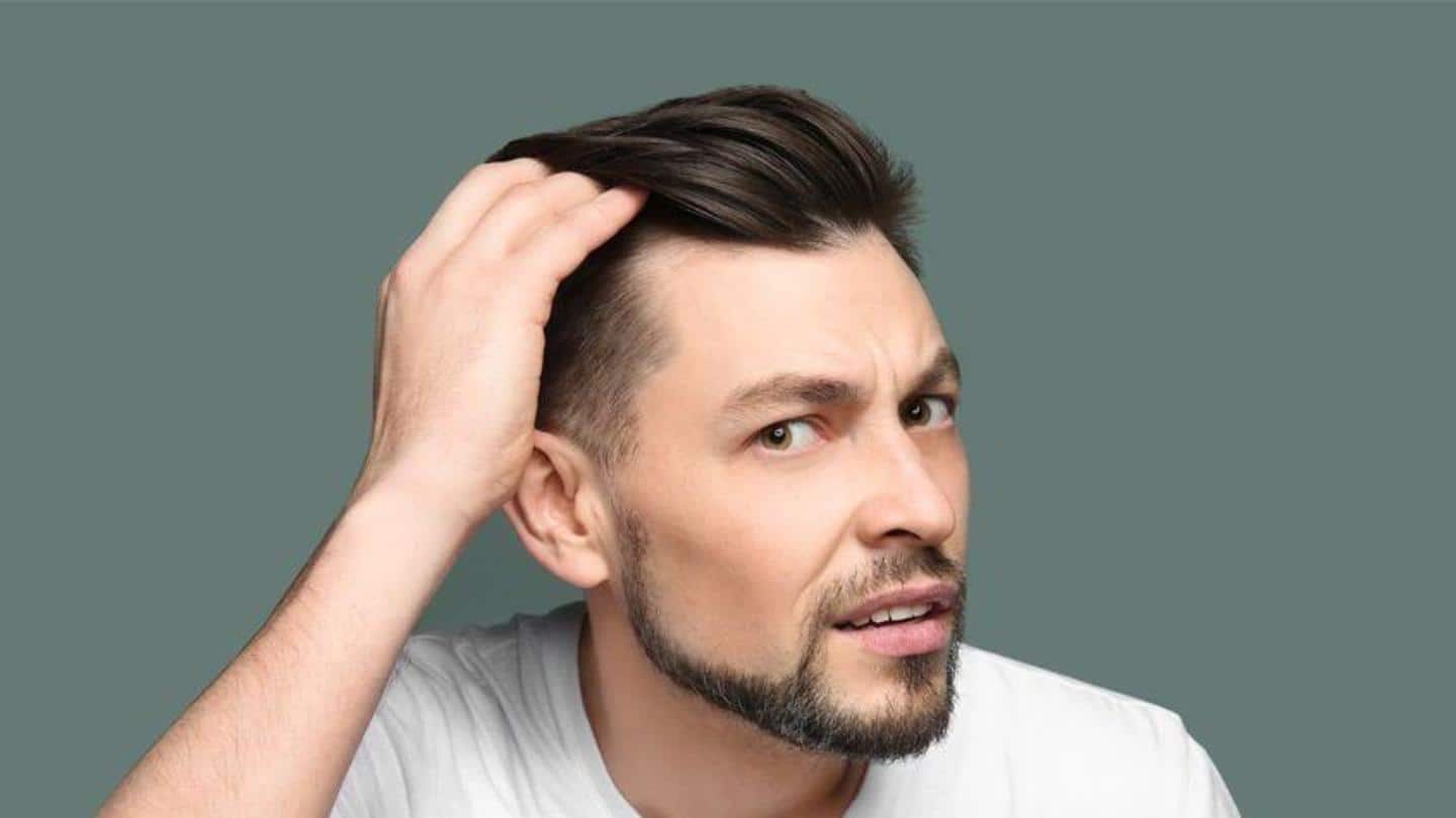Going bald? Some effective ways to stop a receding hairline