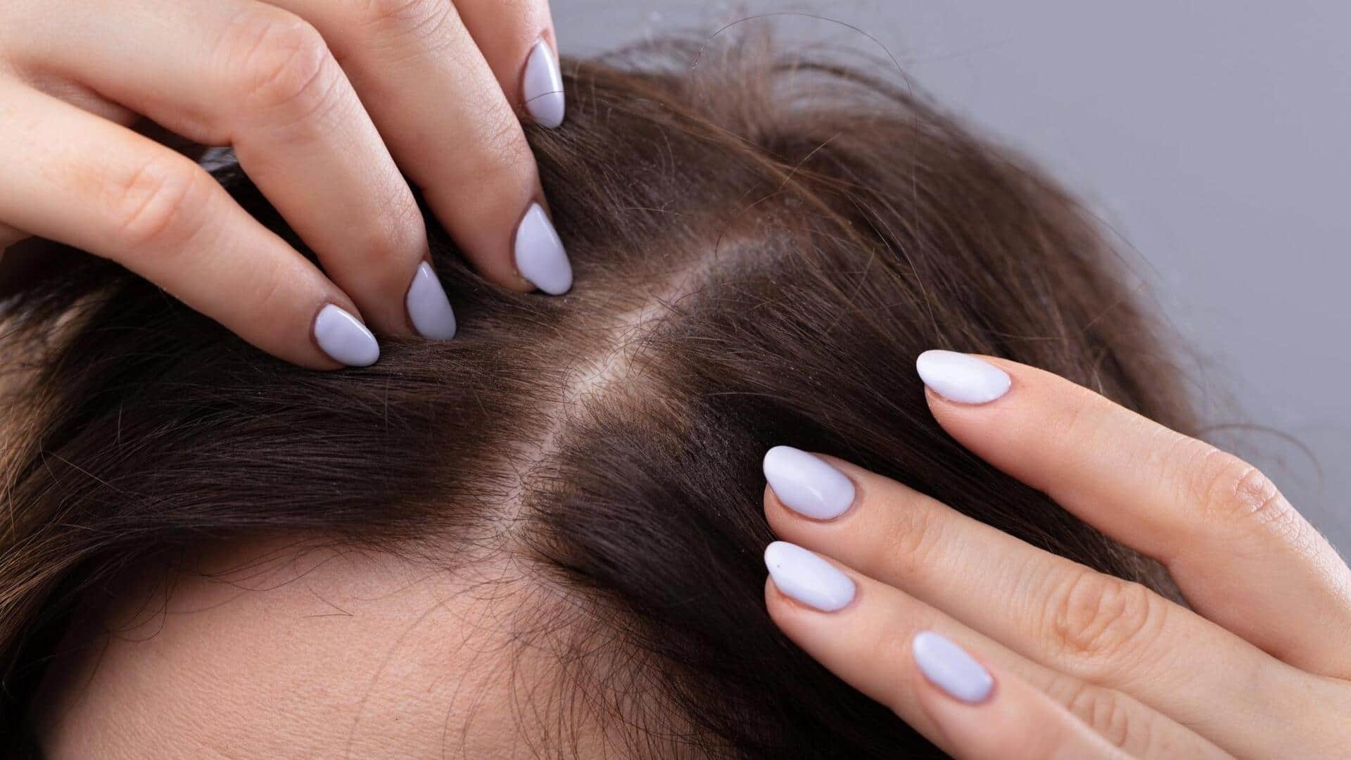 Fix scalp tightness with these kitchen remedies