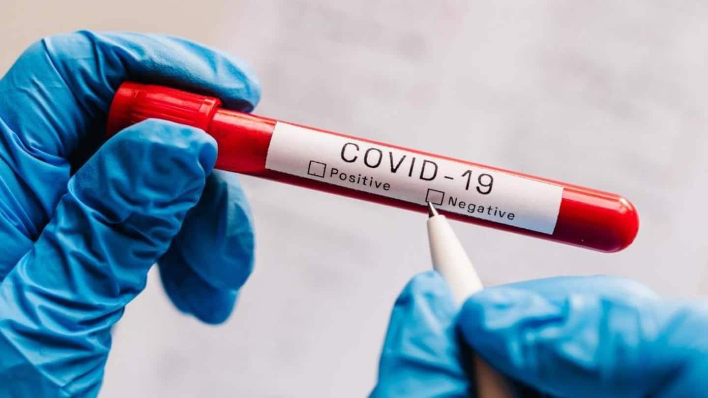 Low viral load may lead to a negative result Low viral load may lead to a negative result