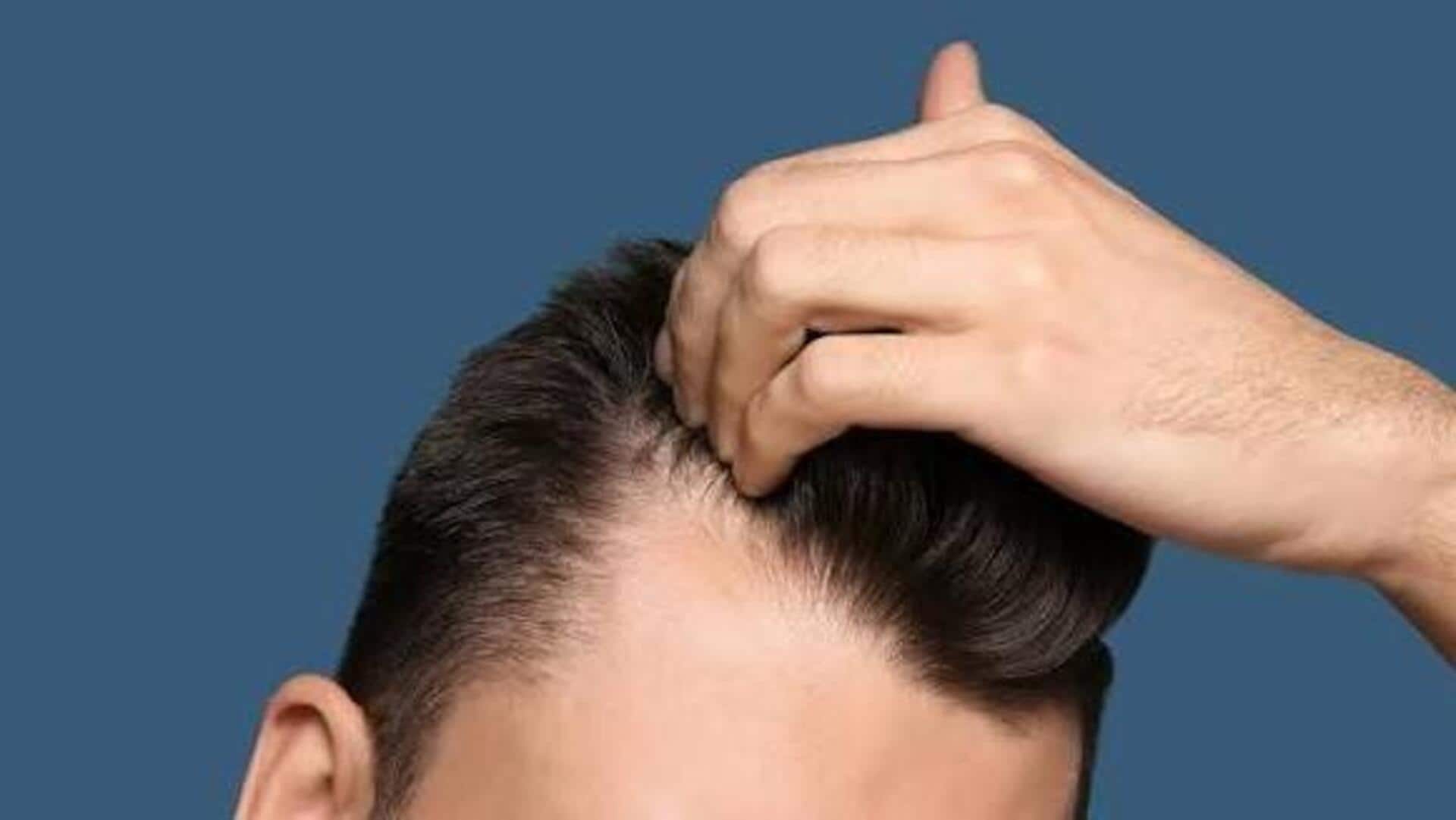How to achieve a flawless hairline 