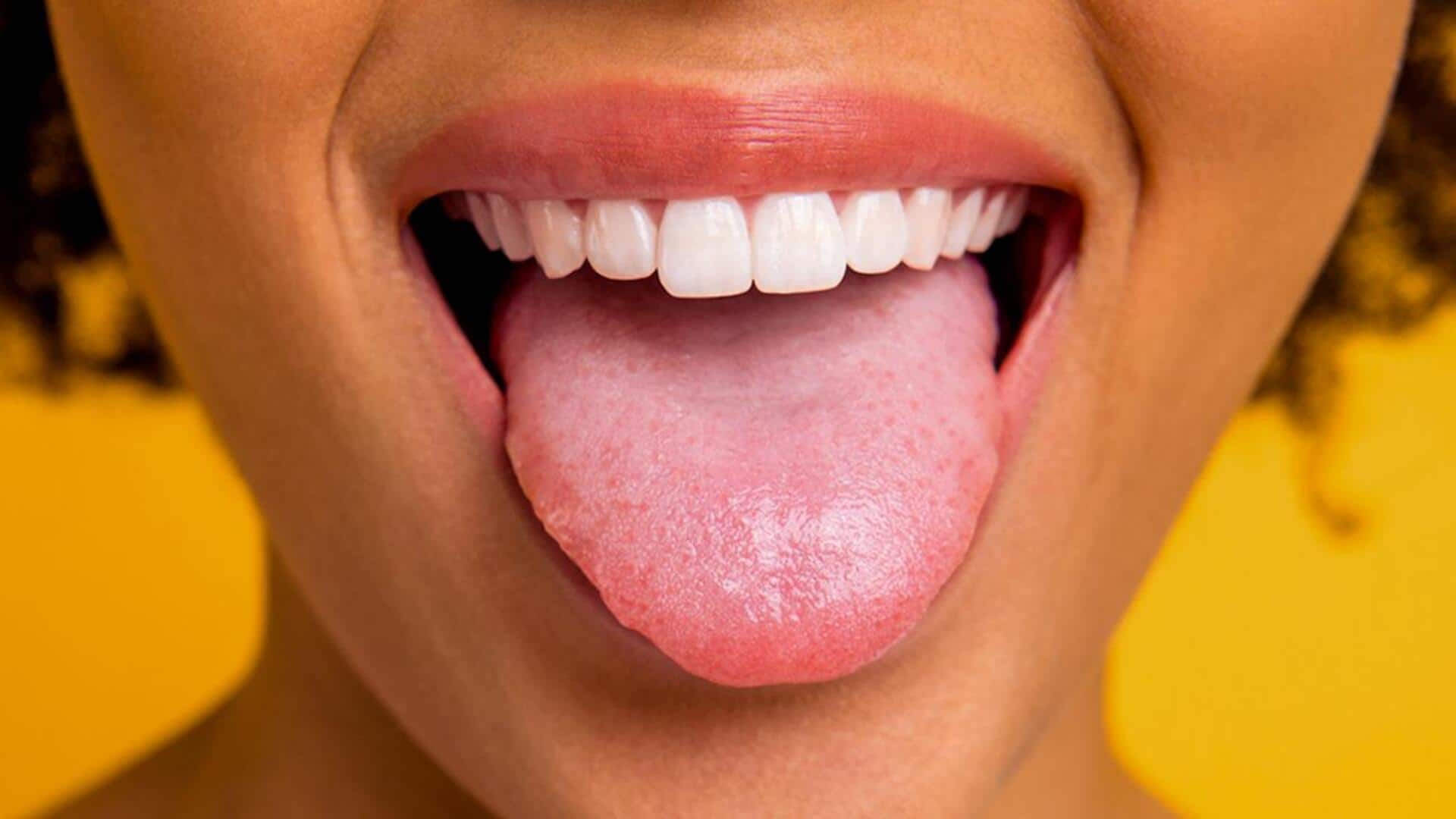 Home remedies for burning sensation on the tongue 