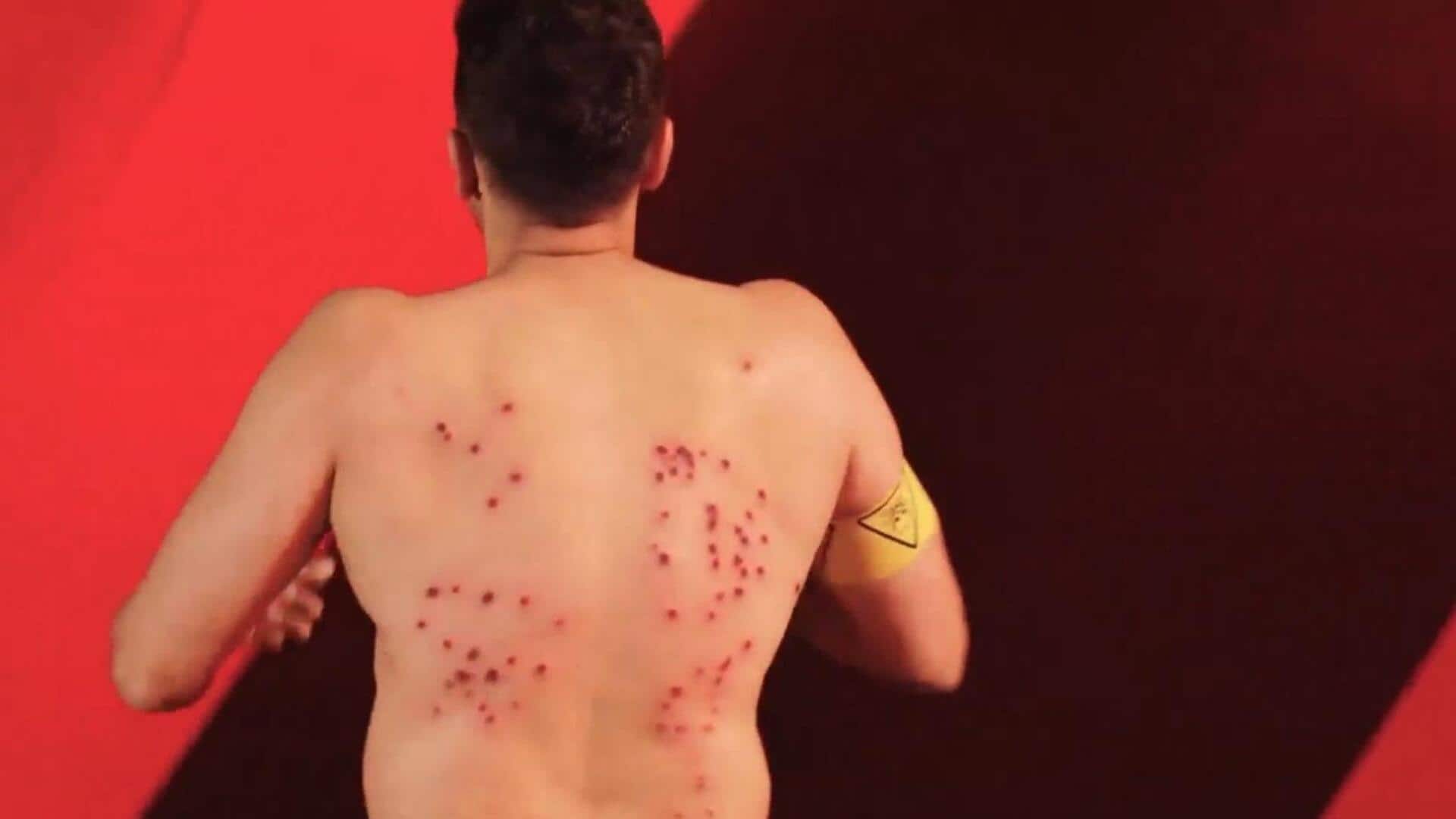'Khatron Ke Khiladi' producers defend rubber bullet stunt: 'Not brutal' 