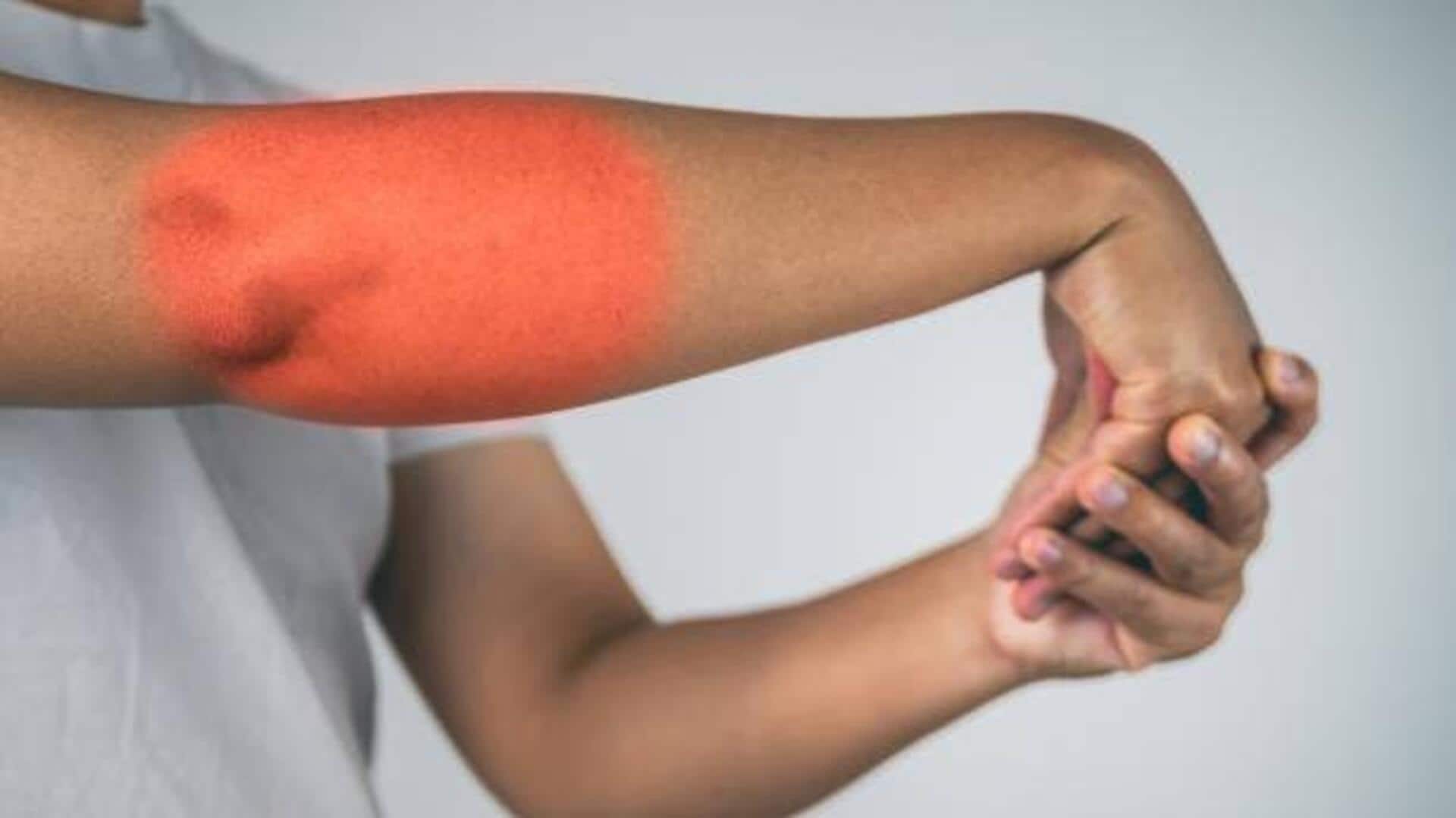 Stiff elbows? These exercises can help