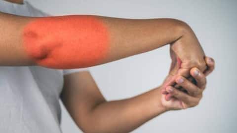 Stiff elbows? These exercises can help