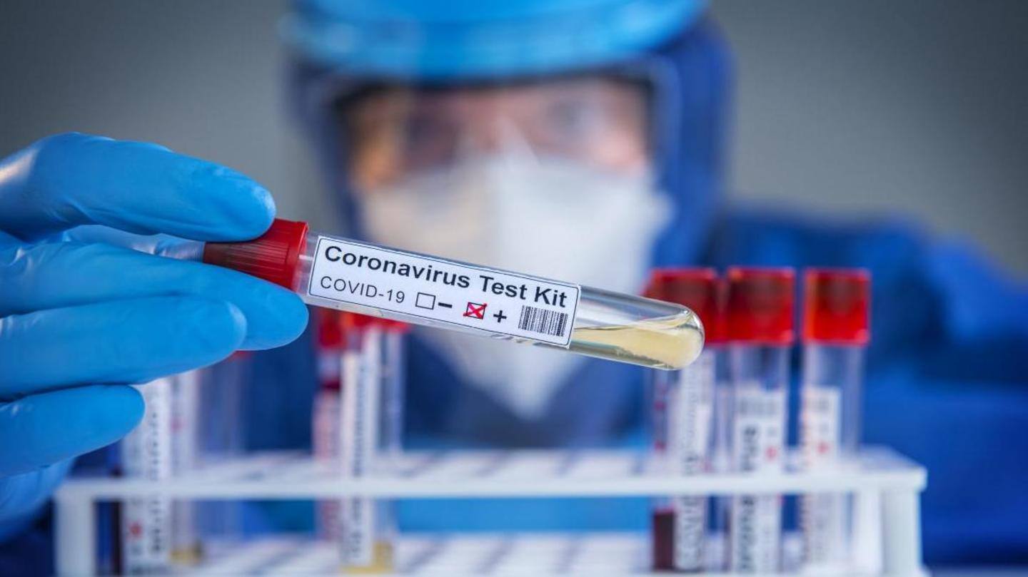 Vaccinated MPs don't have to undertake COVID-19 test Vaccinated MPs don't have to undertake COVID-19 test