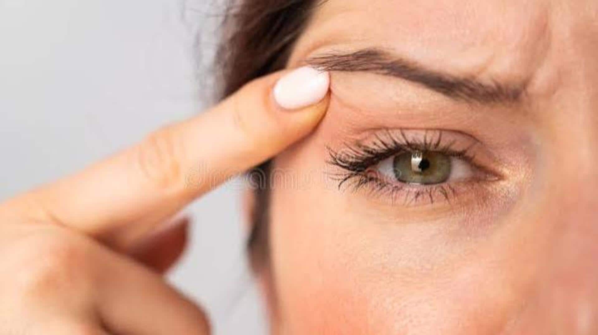 Irritated eyelids? Try these natural remedies