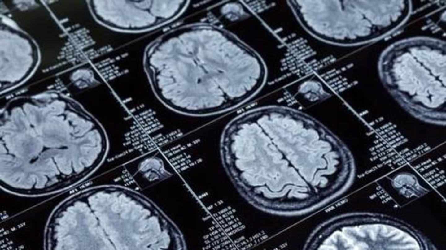 Other hospitals claim similar increase in neurological cases Other hospitals claim similar increase in neurological cases