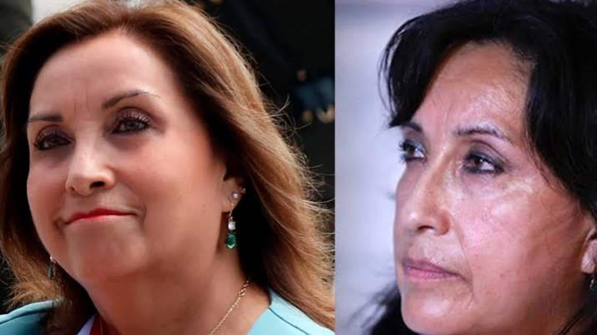 How a nose job triggered political scandal in Peru 