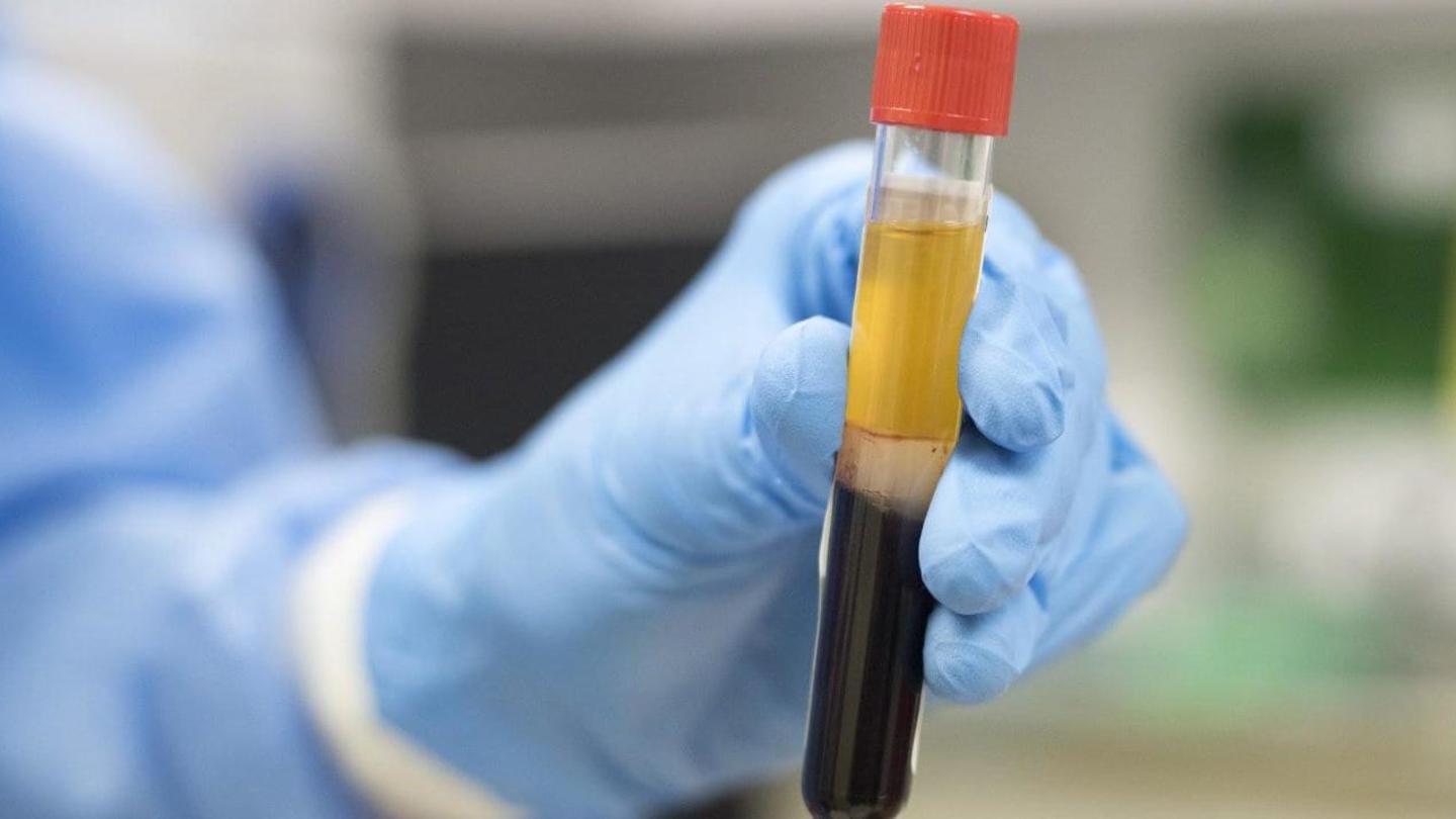 What is plasma therapy? What is plasma therapy?