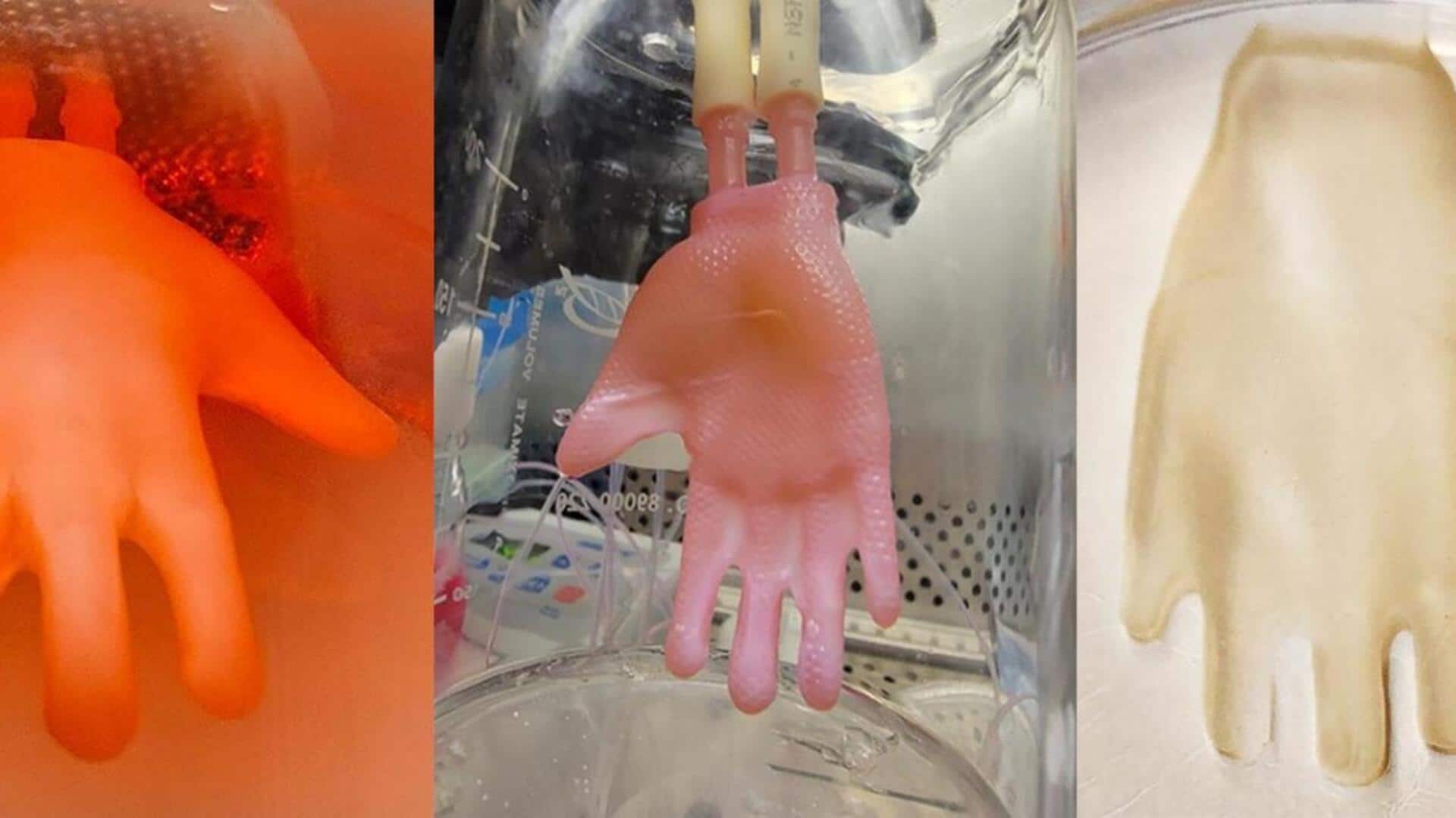 US Army explores 3D skin printing to treat battlefield injuries US Army explores 3D skin printing to treat battlefield injuries