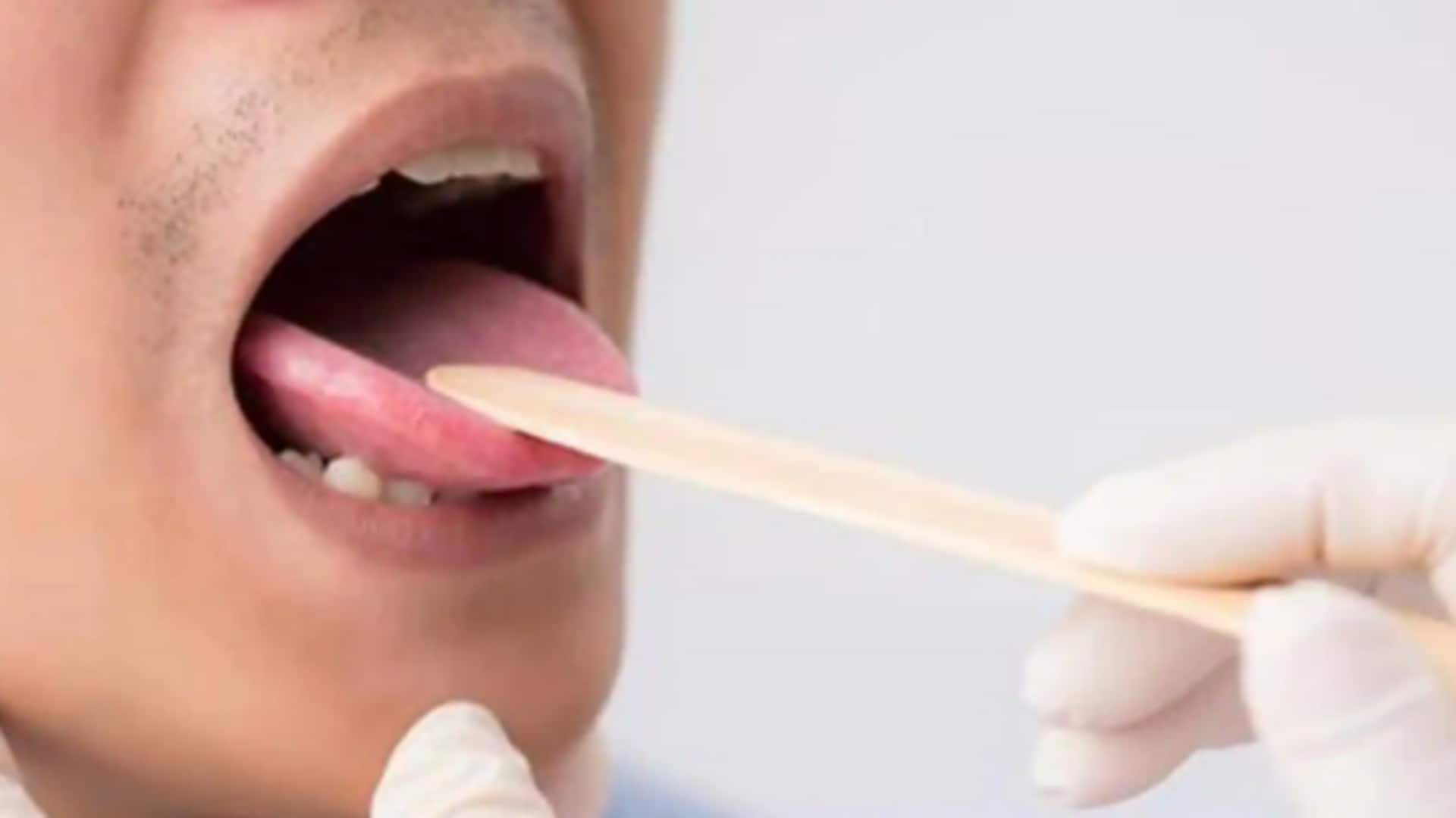5 exercises to strengthen your tongue muscles