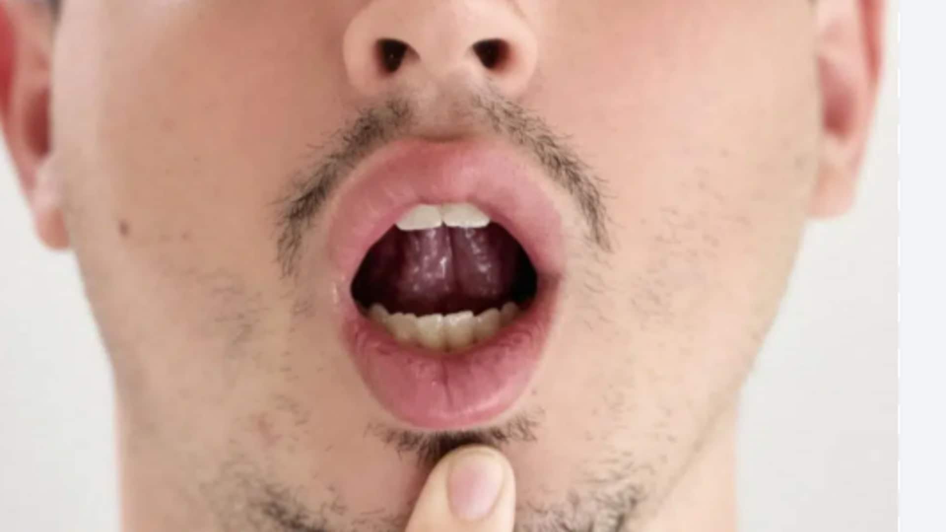 These tongue exercises should be done everyday These tongue exercises should be done everyday