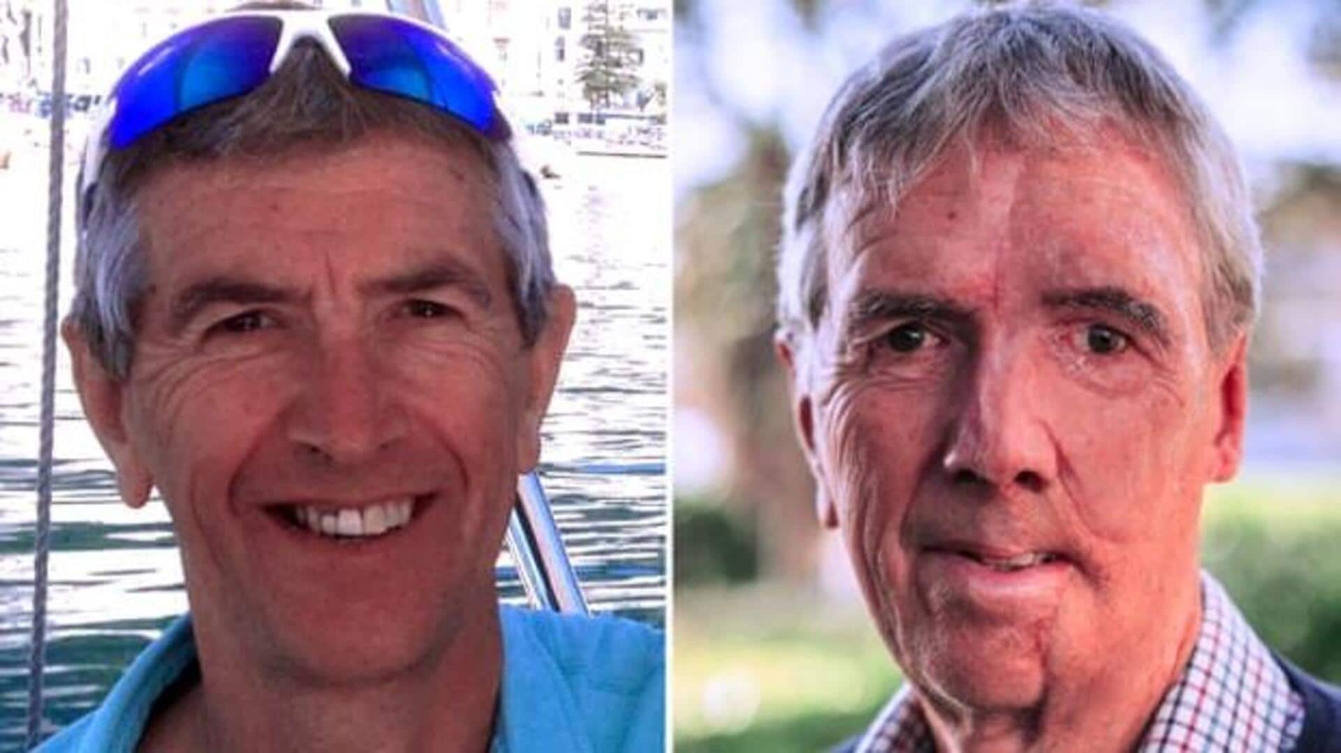 Cyclist gets 3D-printed face after suffering burns in road mishap Cyclist gets 3D-printed face after suffering burns in road mishap