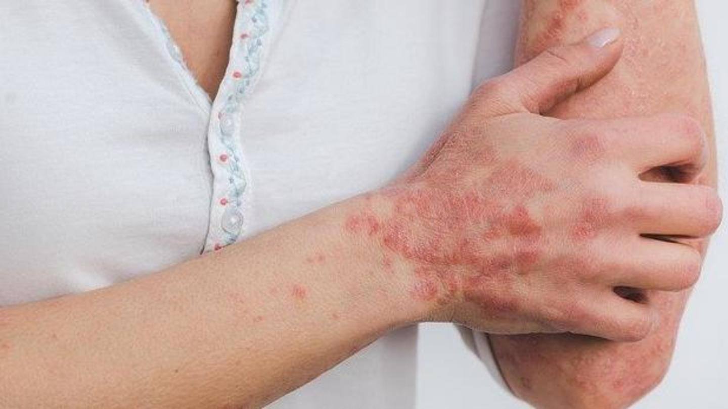 May affect the skin cell structure, causing dermatitis May affect the skin cell structure, causing dermatitis