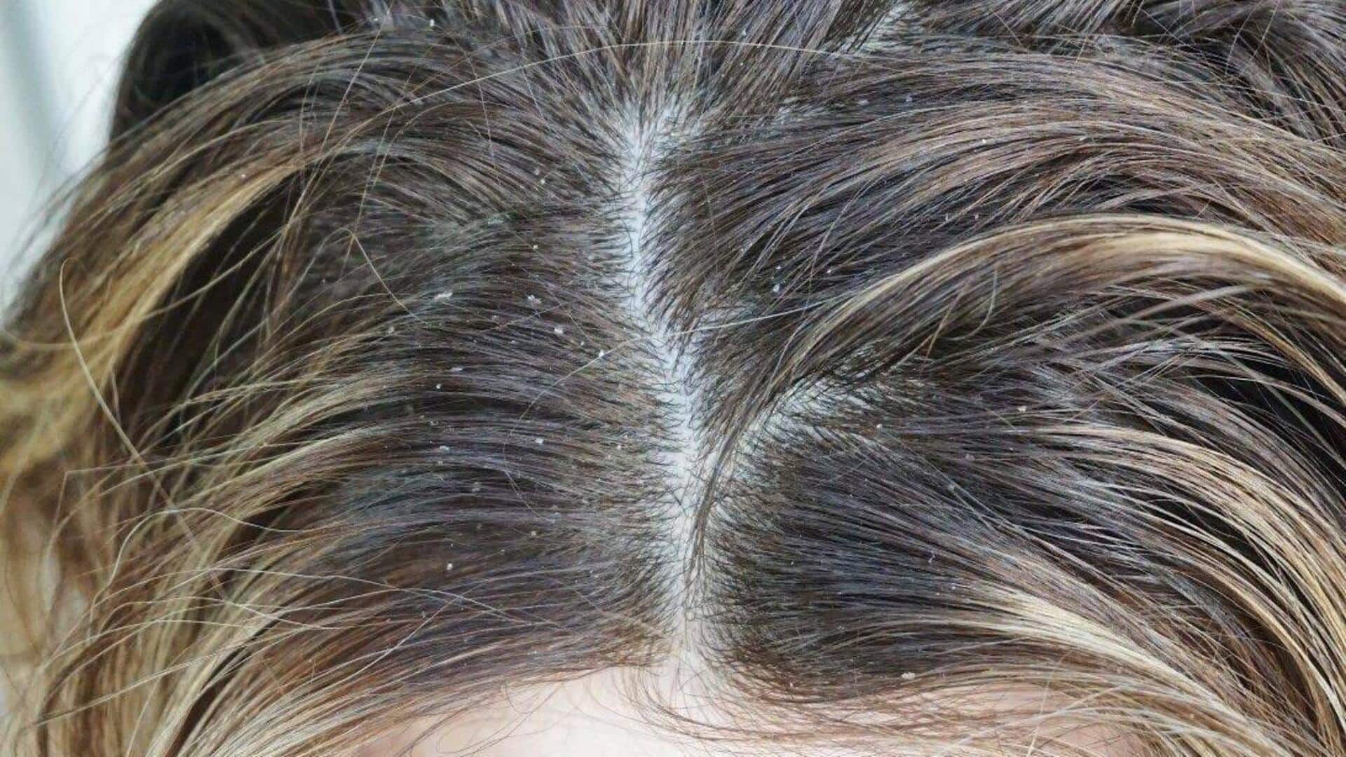 Fix scalp odor with these home remedies