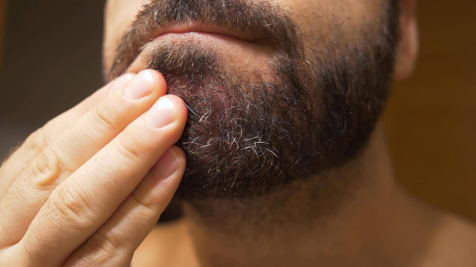 Try these home remedies to get rid of beard dandruff