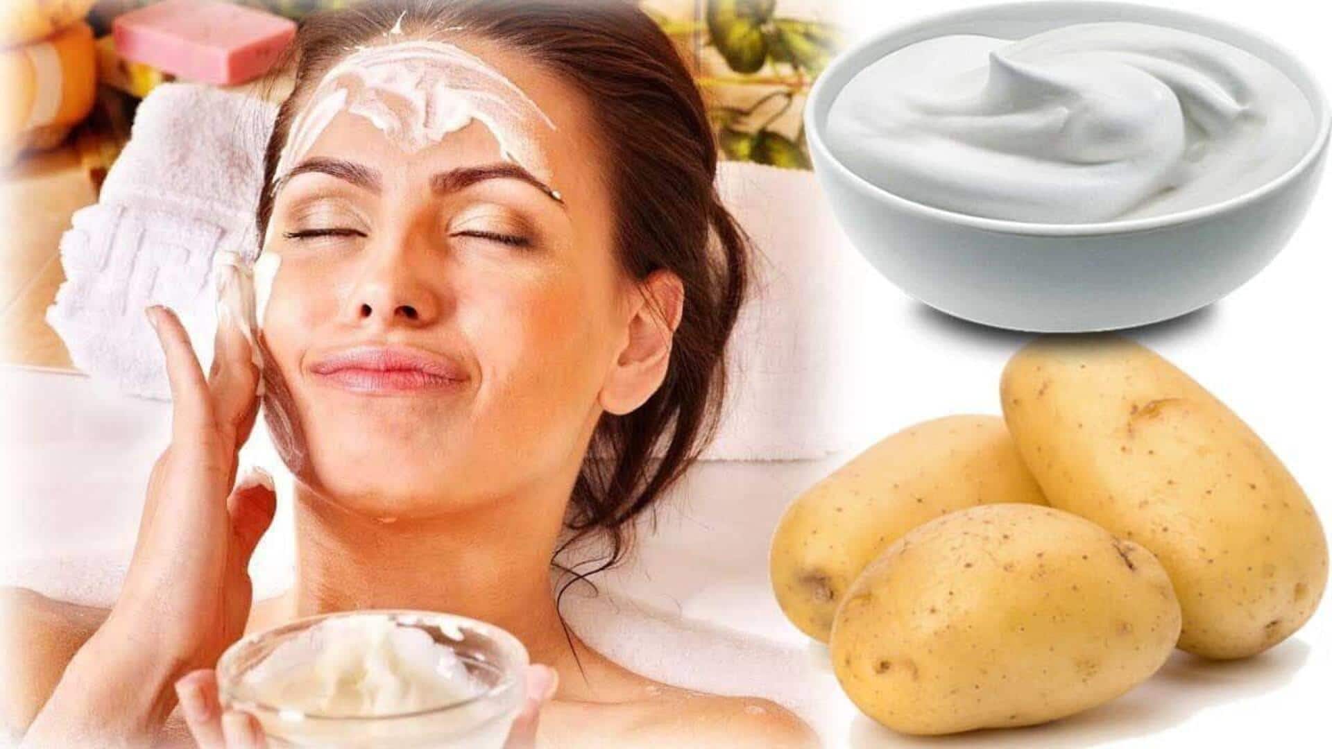Why potato masks should be your go-to for sunburn relief