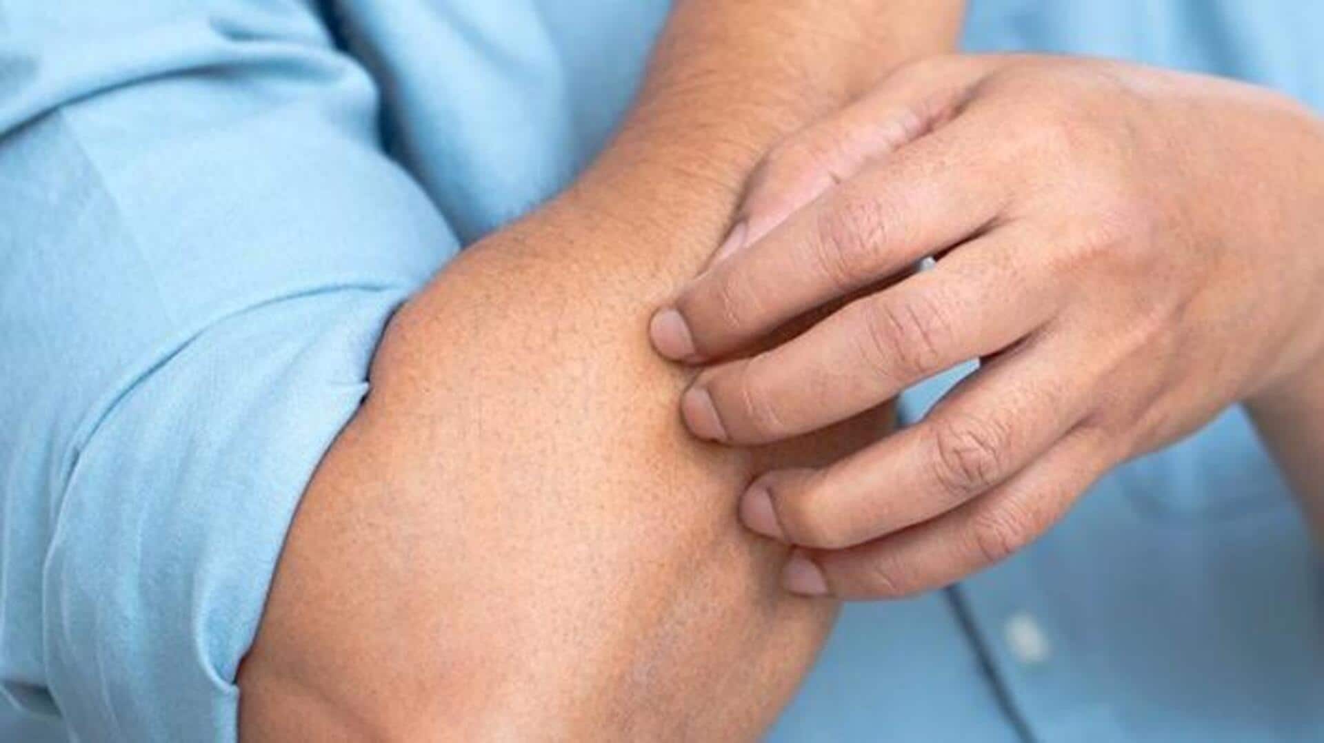 This is how you can soothe itchy skin naturally This is how you can soothe itchy skin naturally