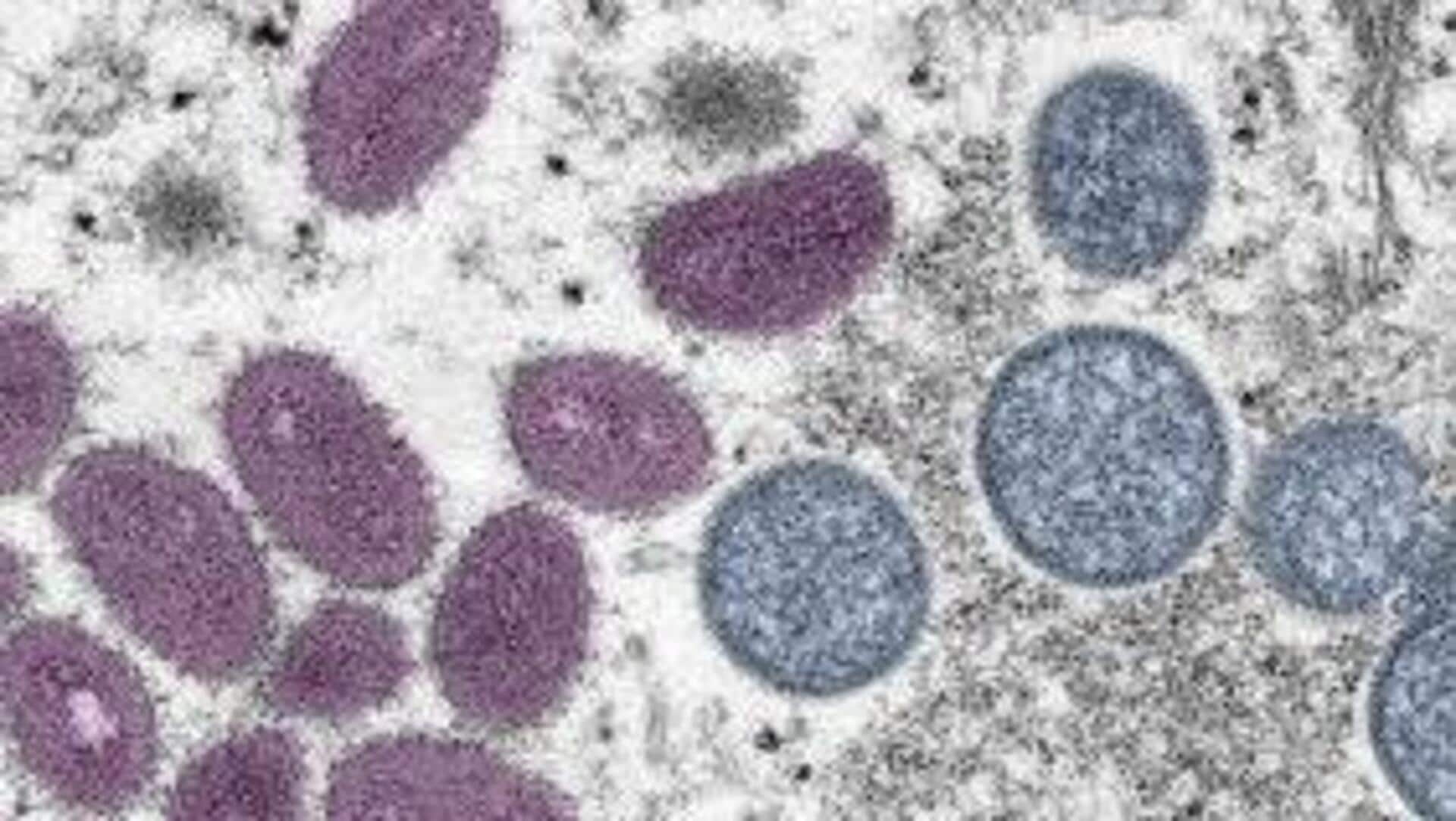 US reports first case of rare mpox strain