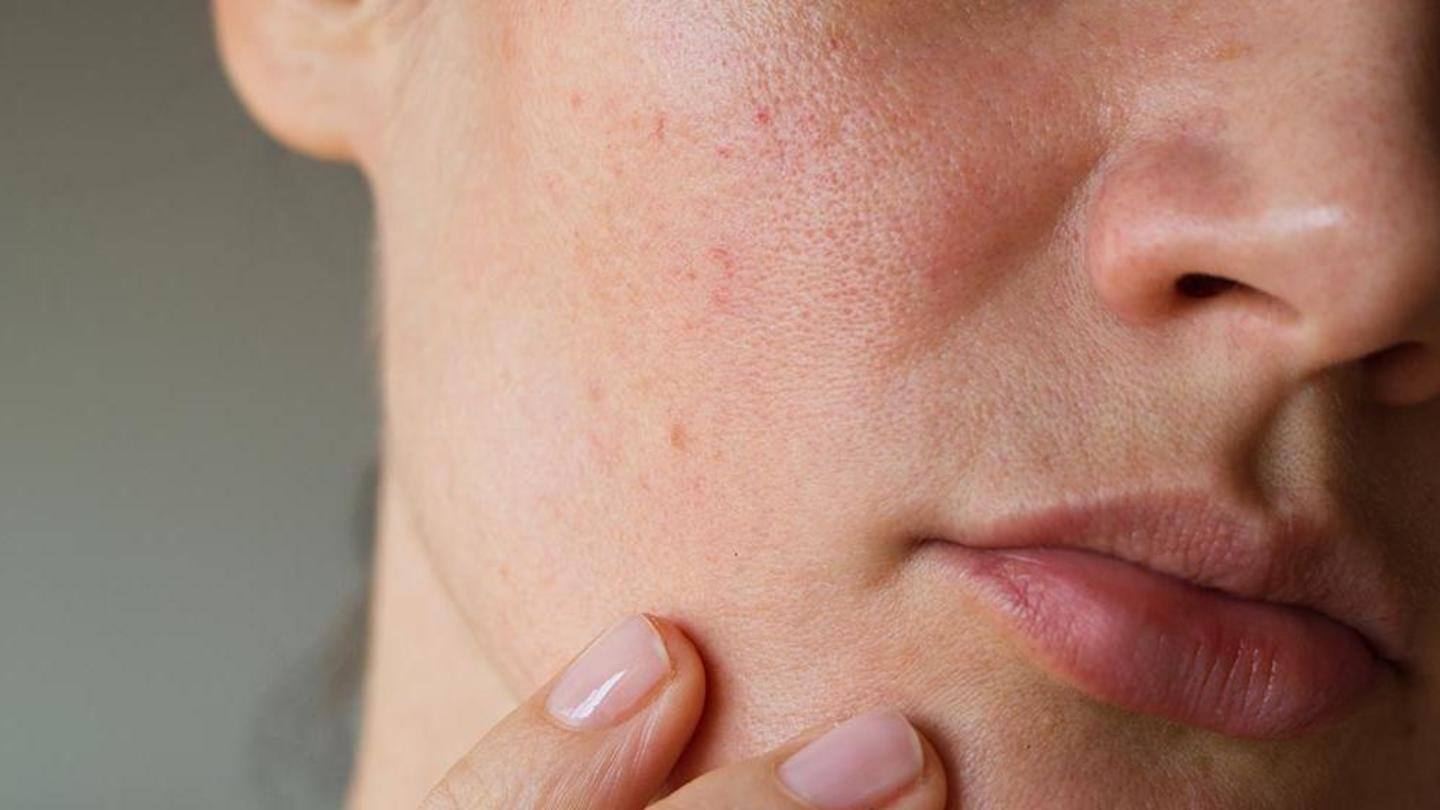 Some effective ways to minimize the appearance of skin pores