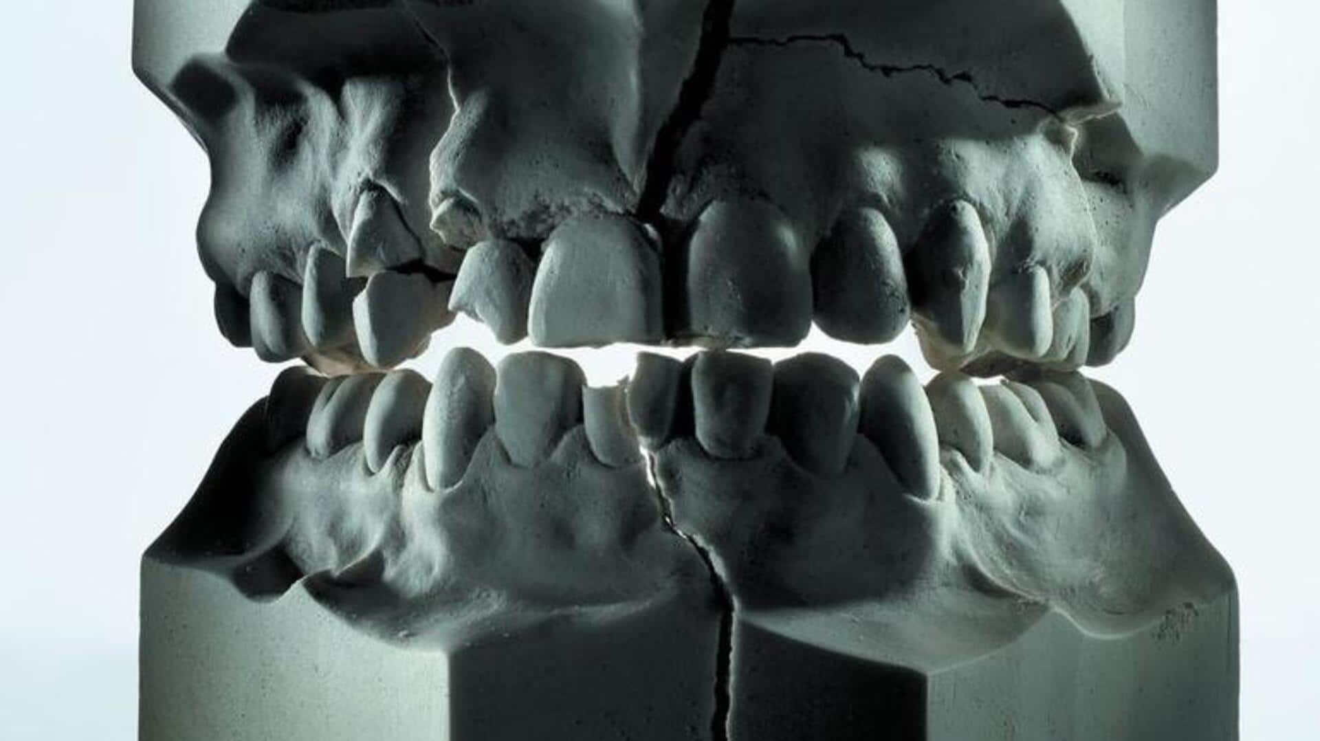 Scientists unearth pathogens from 800-year-old teeth: Here's how