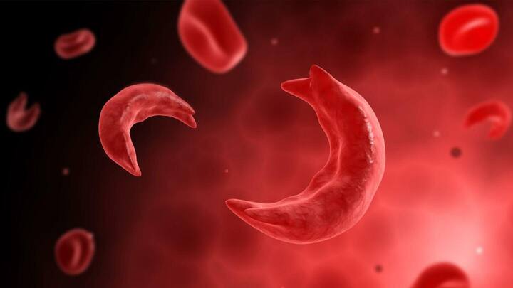 What's sickle cell anemia that India would eliminate by 2047