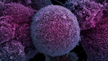 Resistant starch can lower hereditary cancer risk by over 60%