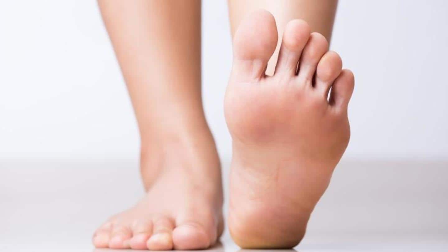 A few effective remedies to get rid of peeling feet