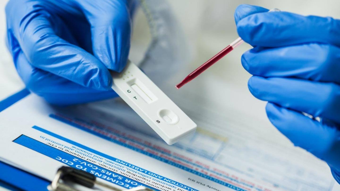 An antibody test detects antibodies against the virus An antibody test detects antibodies against the virus