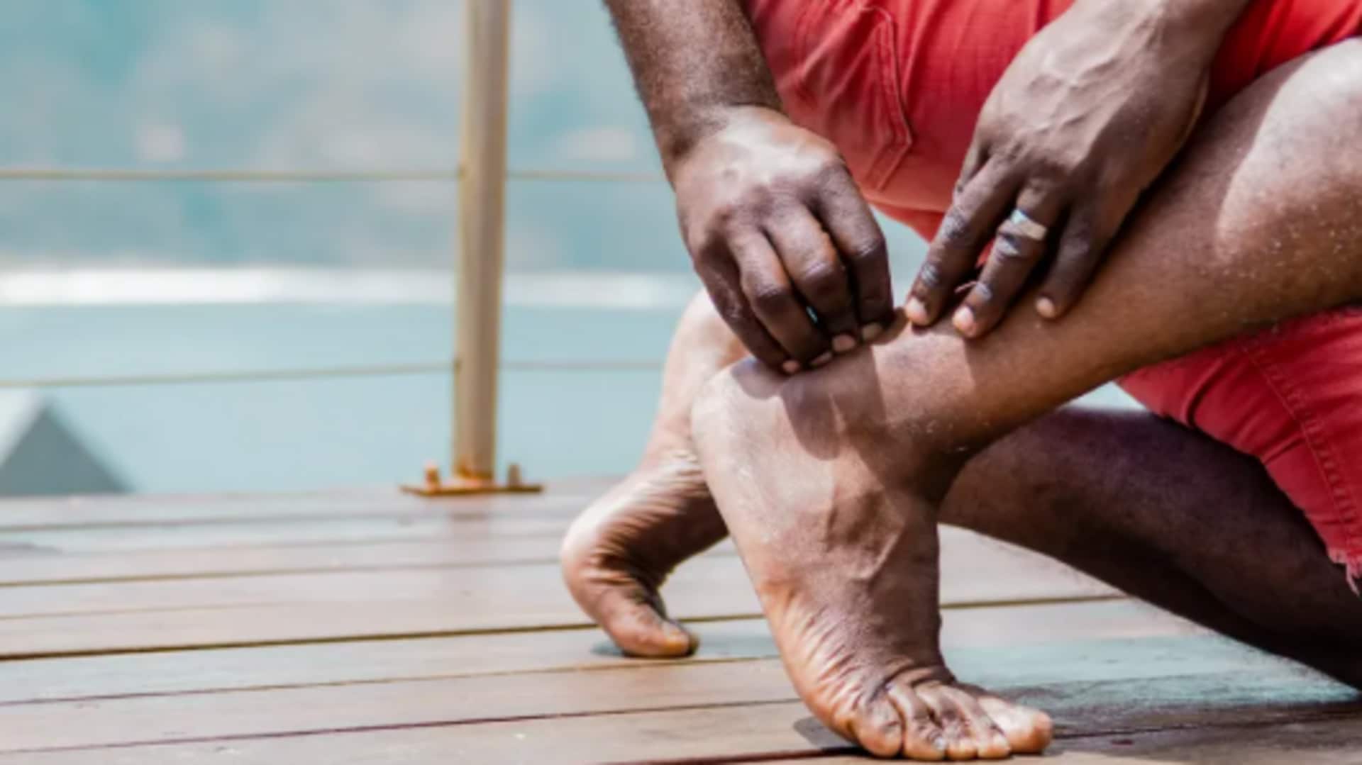 Leg day: Don't forget these ankle exercises Leg day: Don't forget these ankle exercises
