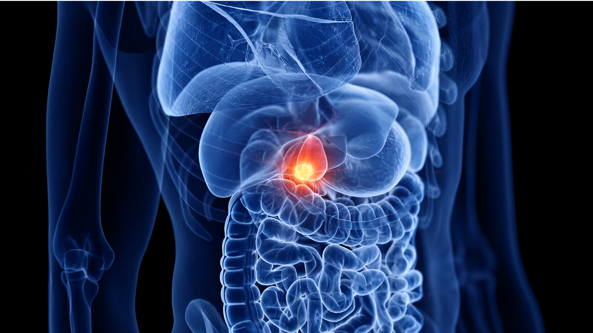 Early detection of gallbladder cancer might soon become easier