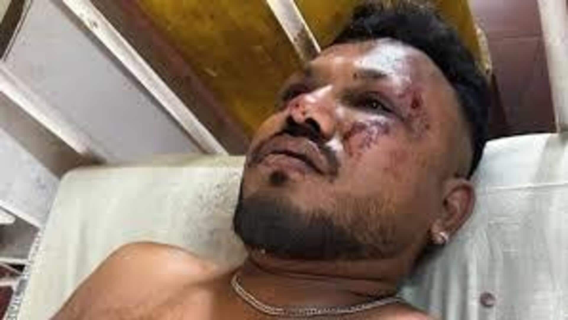 'Luckiest man alive, but....': Air India crash sole survivor 