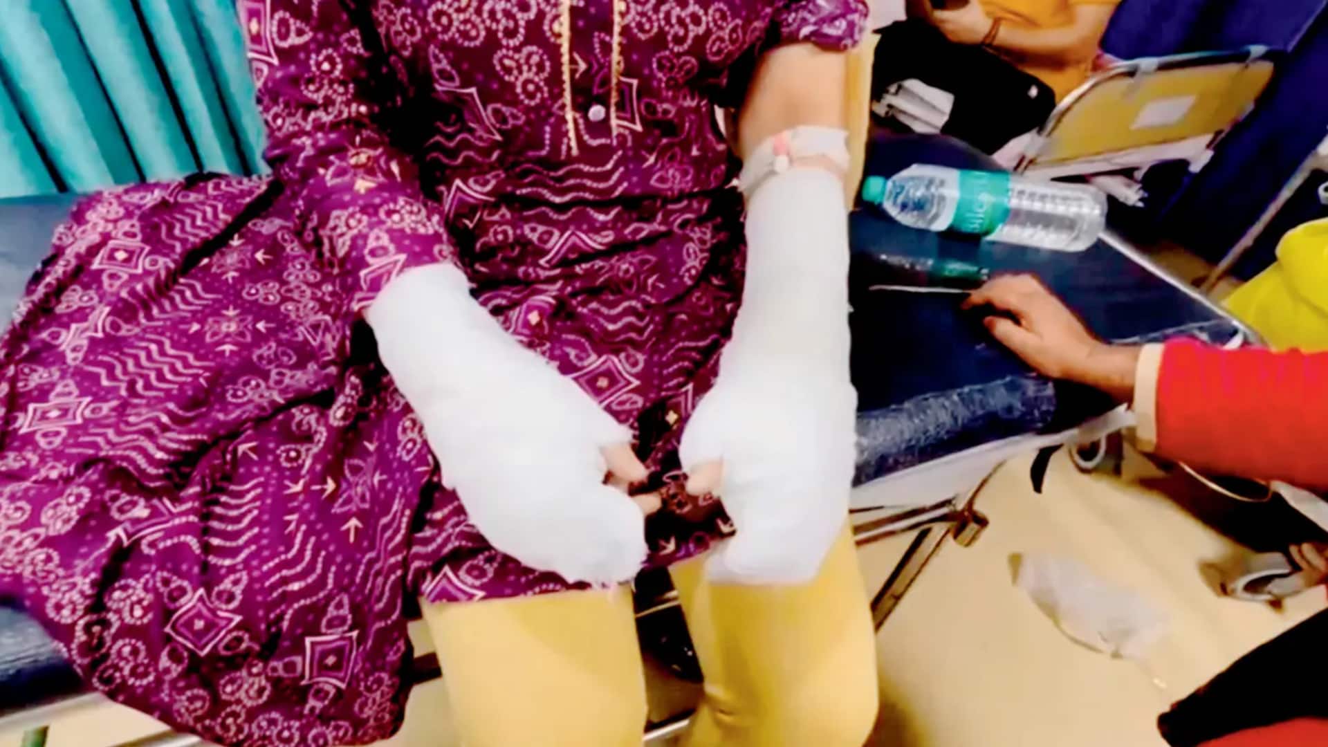 Delhi student, father booked for staging acid attack for revenge Delhi student, father booked for staging acid attack for revenge