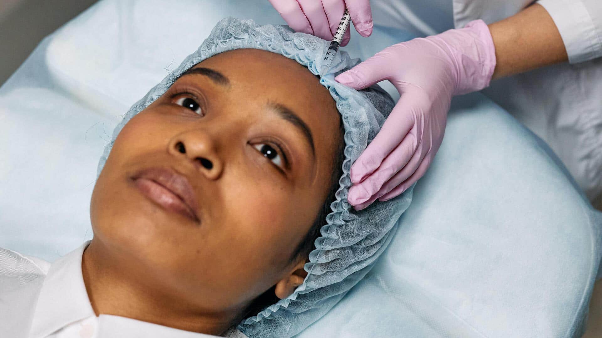 Get younger-looking skin with microneedling  