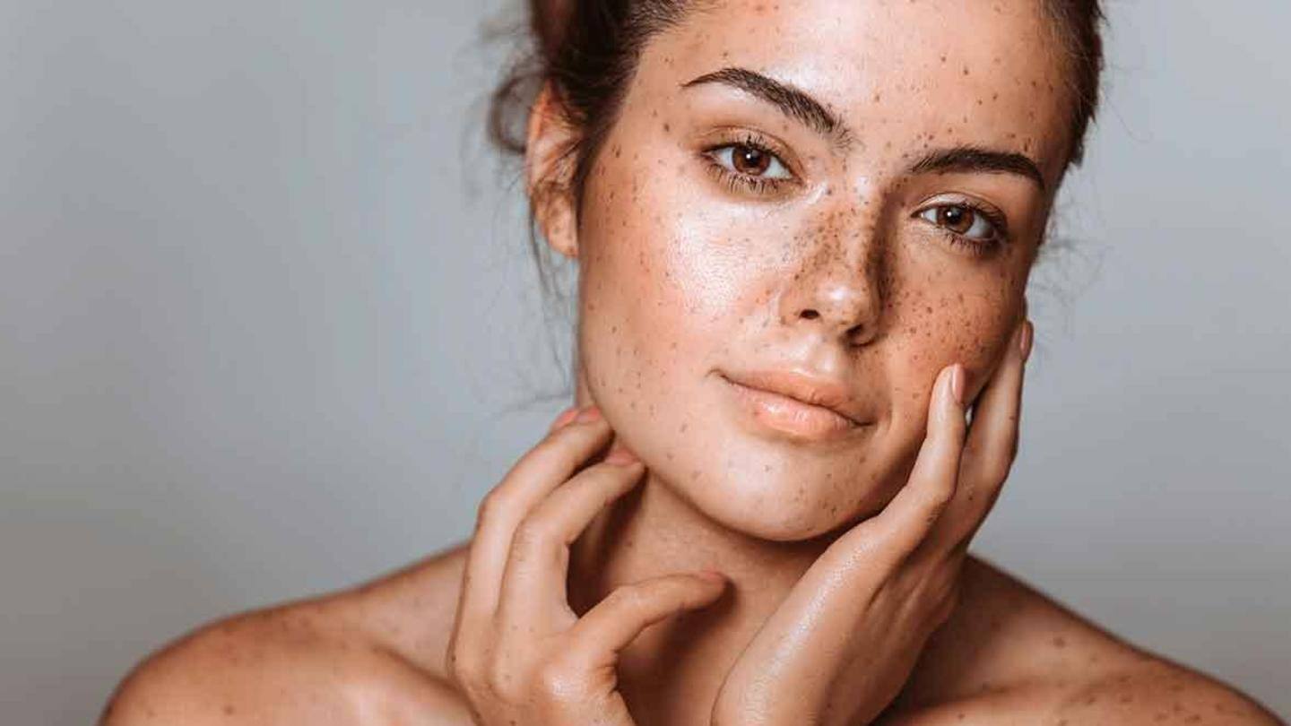 A combination of vitamin C and sunscreen helps reduce discoloration A combination of vitamin C and sunscreen helps reduce discoloration