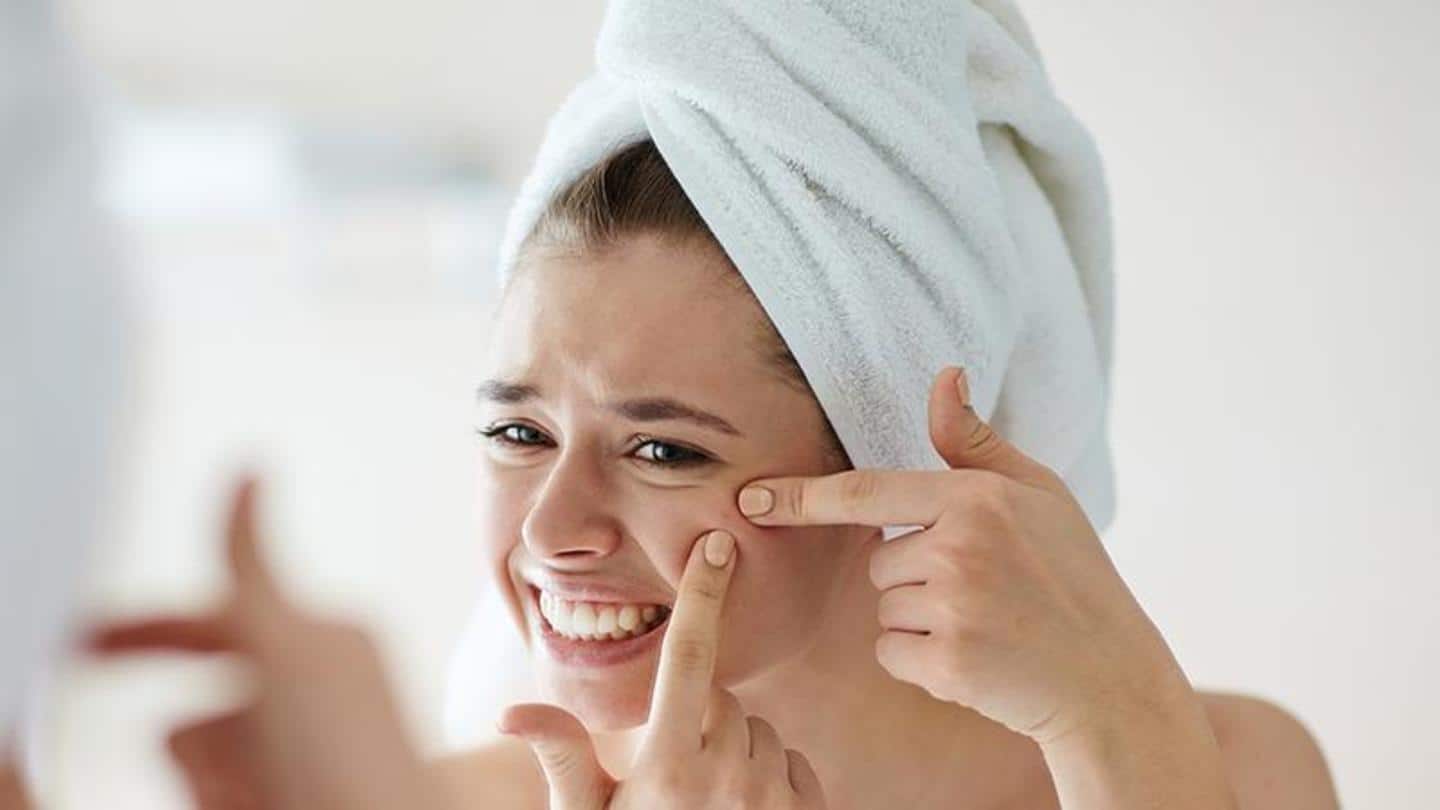 Having acne but don't know why? This guide may help