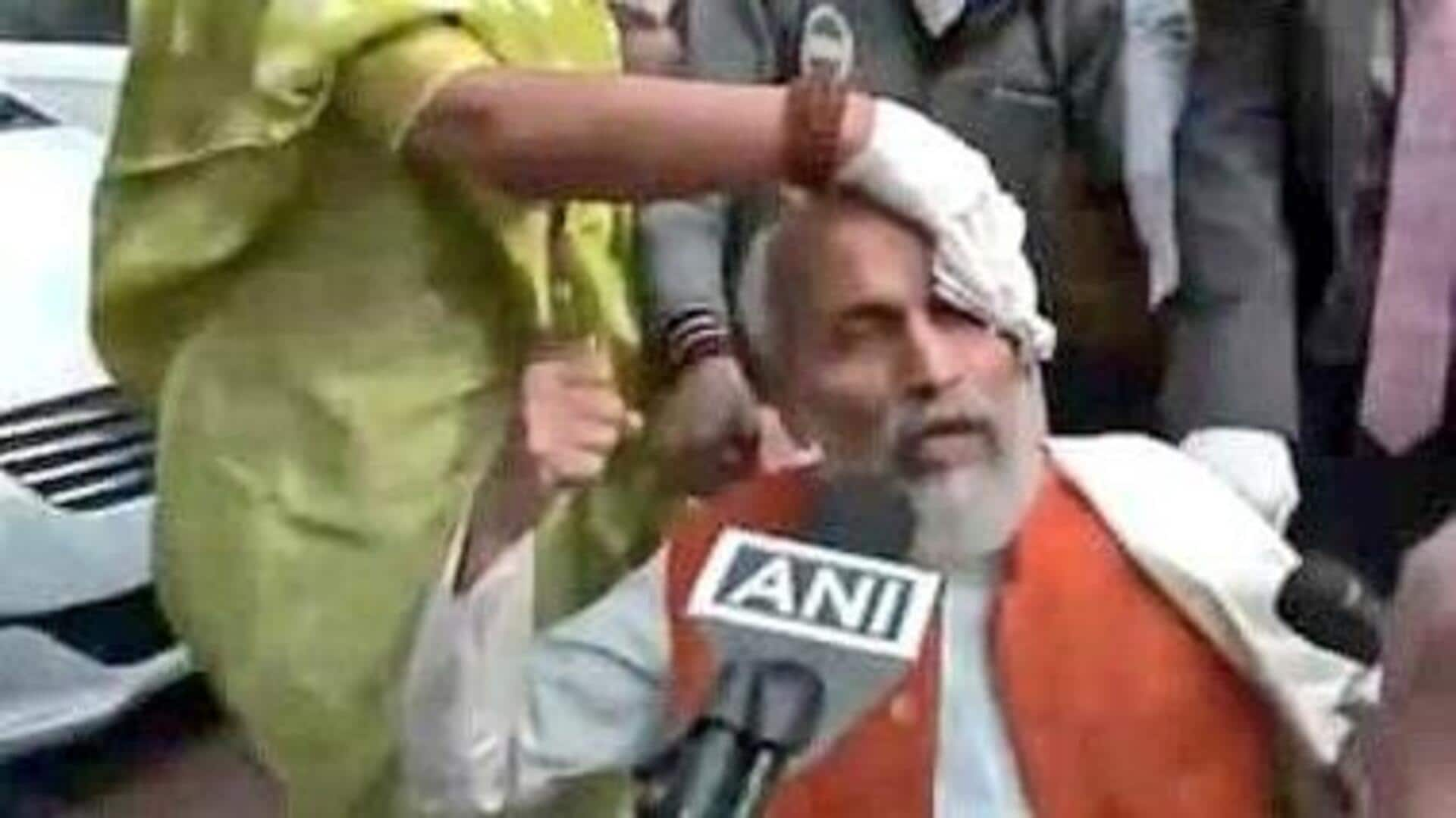 'Rahul Gandhi…pushed me': BJP MP sustains head injury during protest  