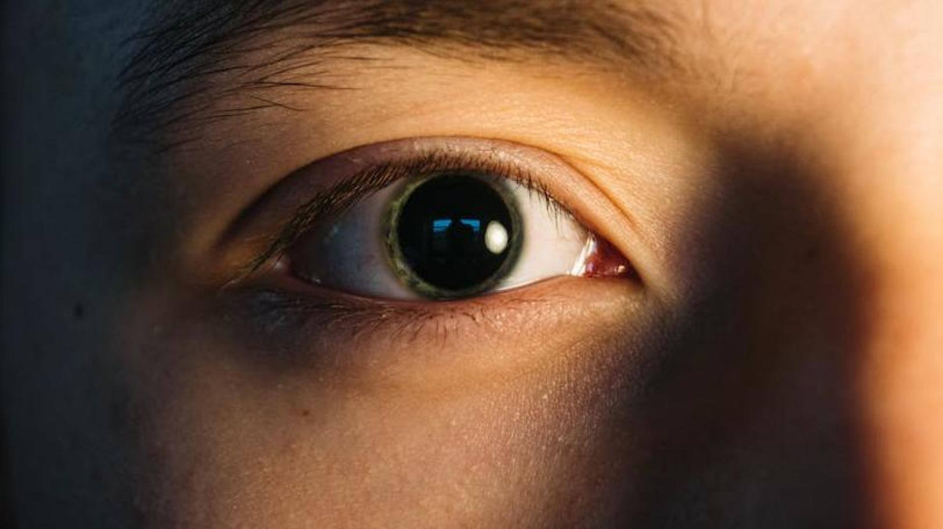 Glaucoma: Understanding the symptoms, causes, and treatment