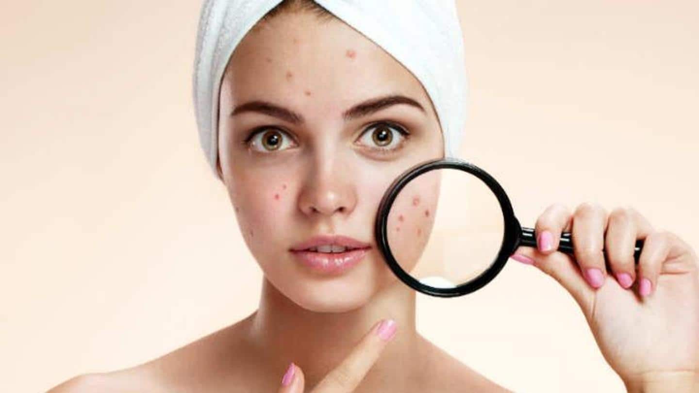 Home remedies that work to remove dark spots on face