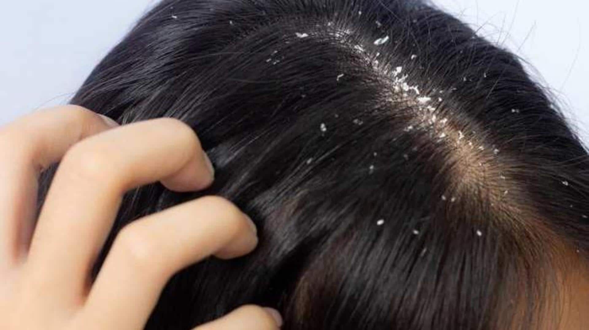 Say goodbye to dandruff with fenugreek seed rinse Say goodbye to dandruff with fenugreek seed rinse