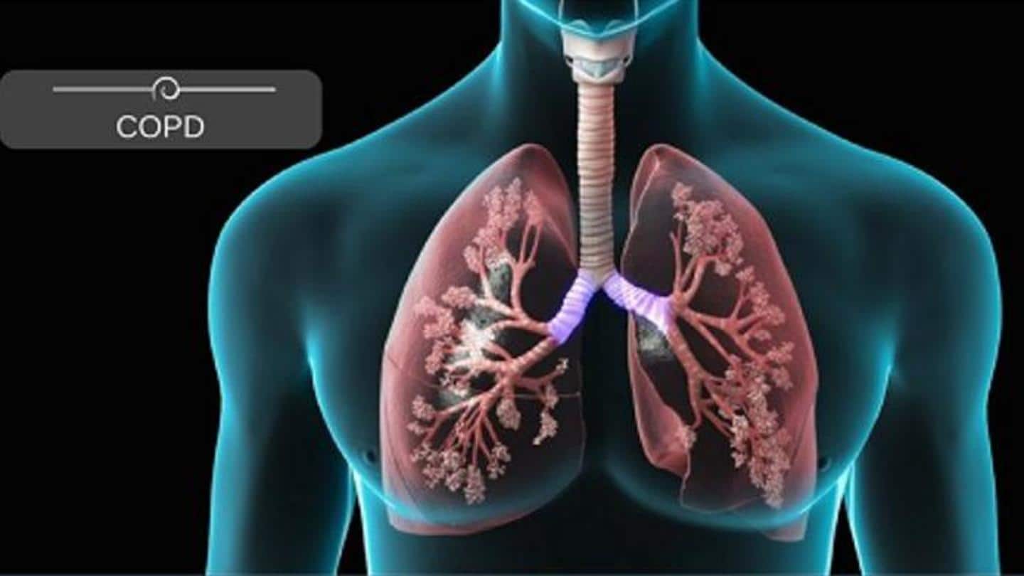 He is also a patient of Chronic Obstructive Pulmonary Disease He is also a patient of Chronic Obstructive Pulmonary Disease