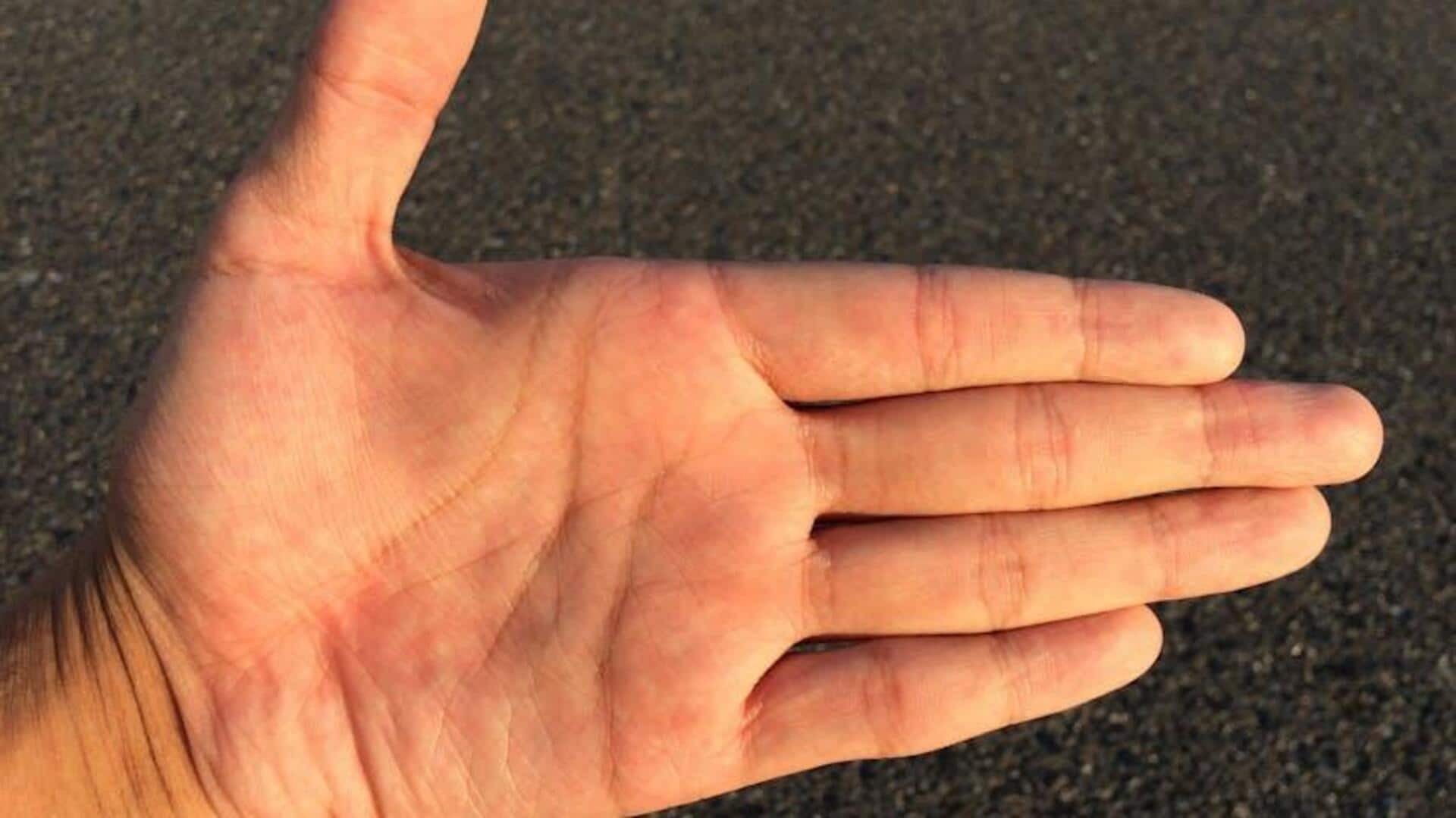 Strengthening finger extensors: Top five exercises