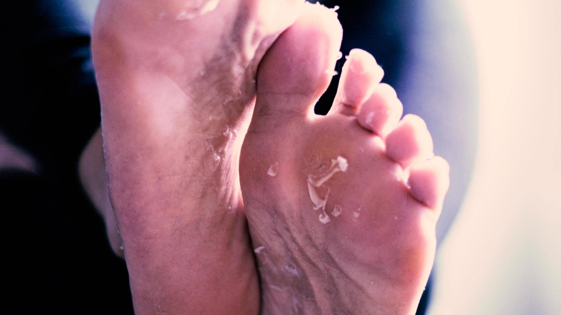 Horse Oil Feet Cream Heel Cream For Athlete's Foot Itch Cream Mask Feet  X6T1 | eBay