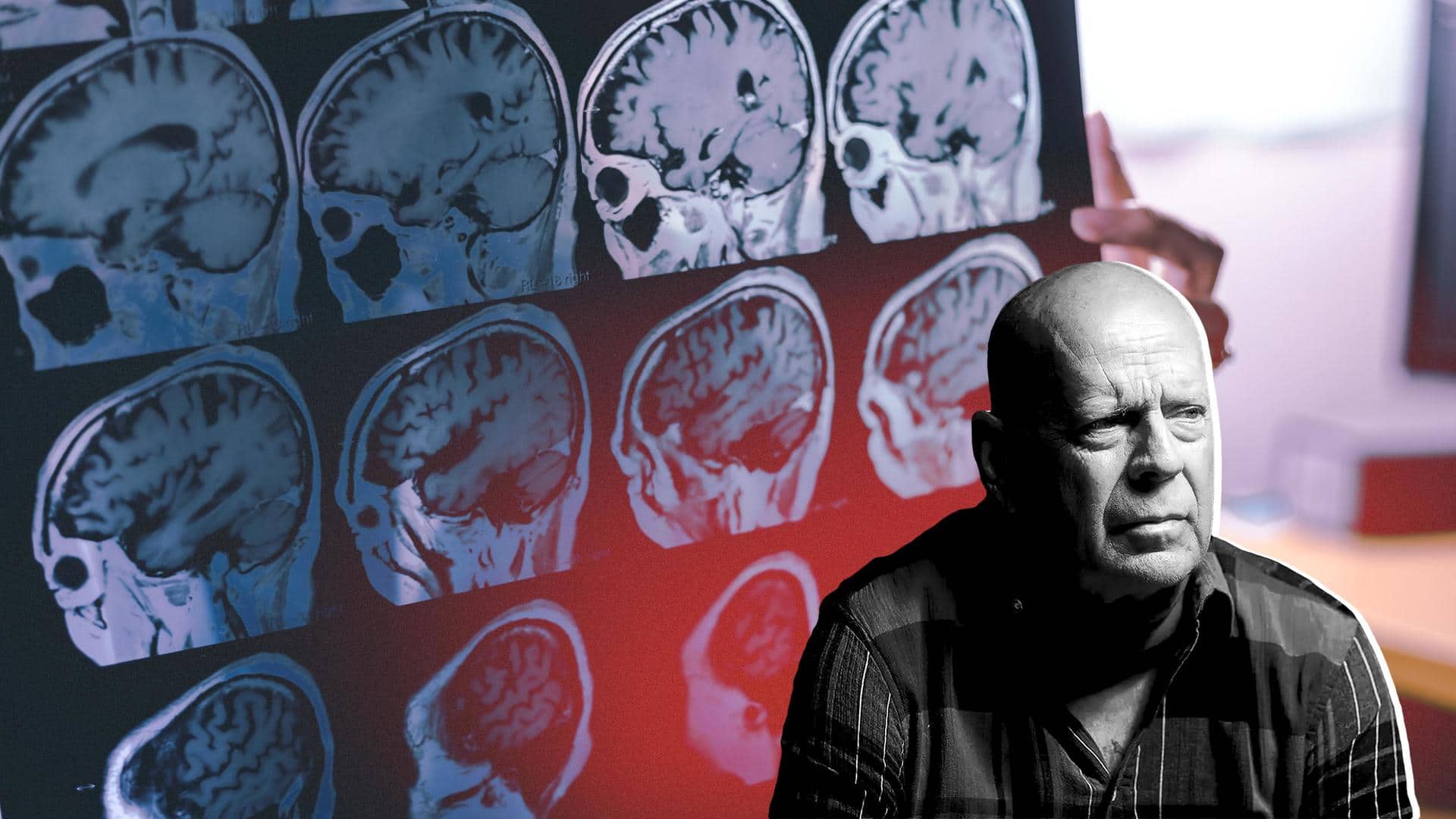#NewsBytesExplainer: What's frontotemporal dementia? The disease Bruce Willis is battling