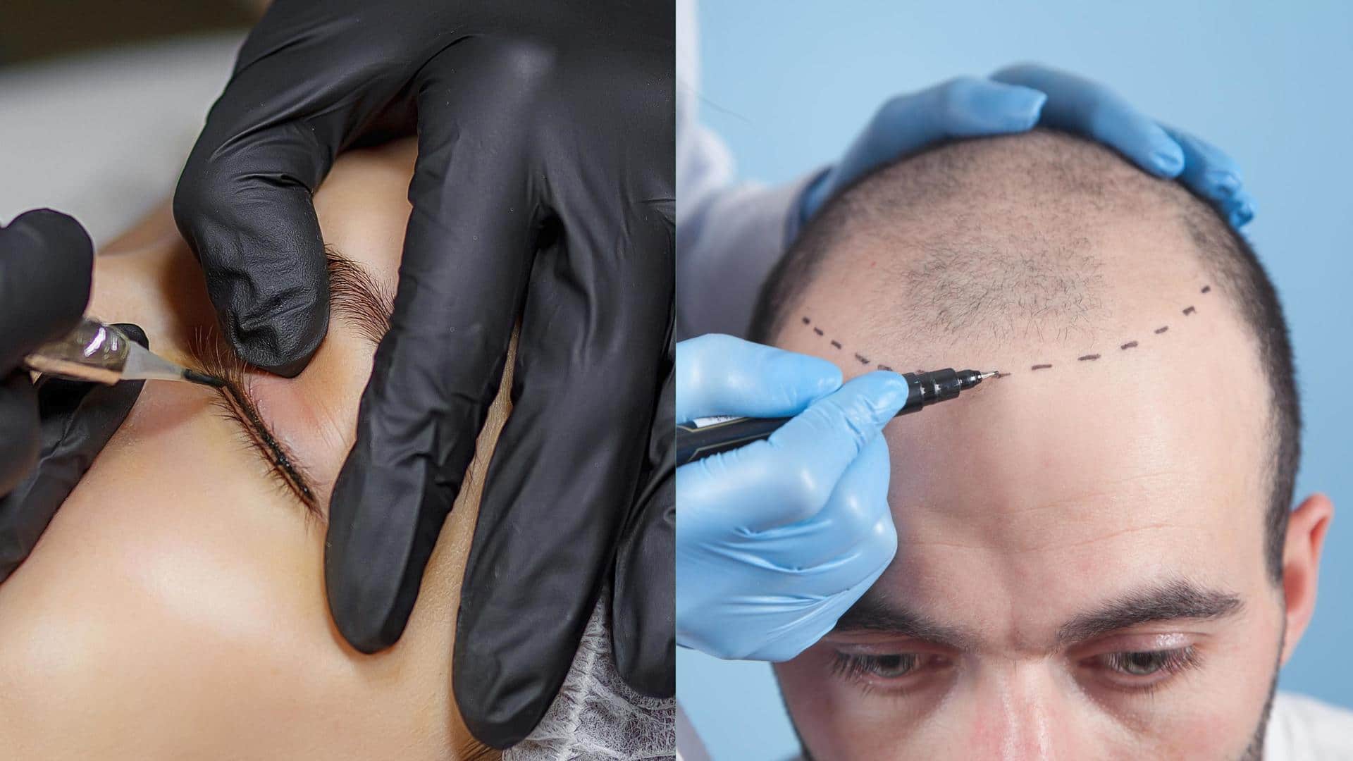 How scalp micro-pigmentation is changing lives