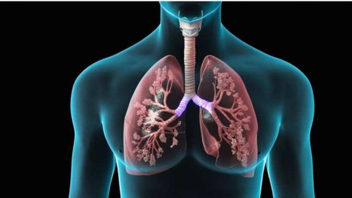 Long-term lung damage after COVID-19? New study weighs in Long-term lung damage after COVID-19? New study weighs in