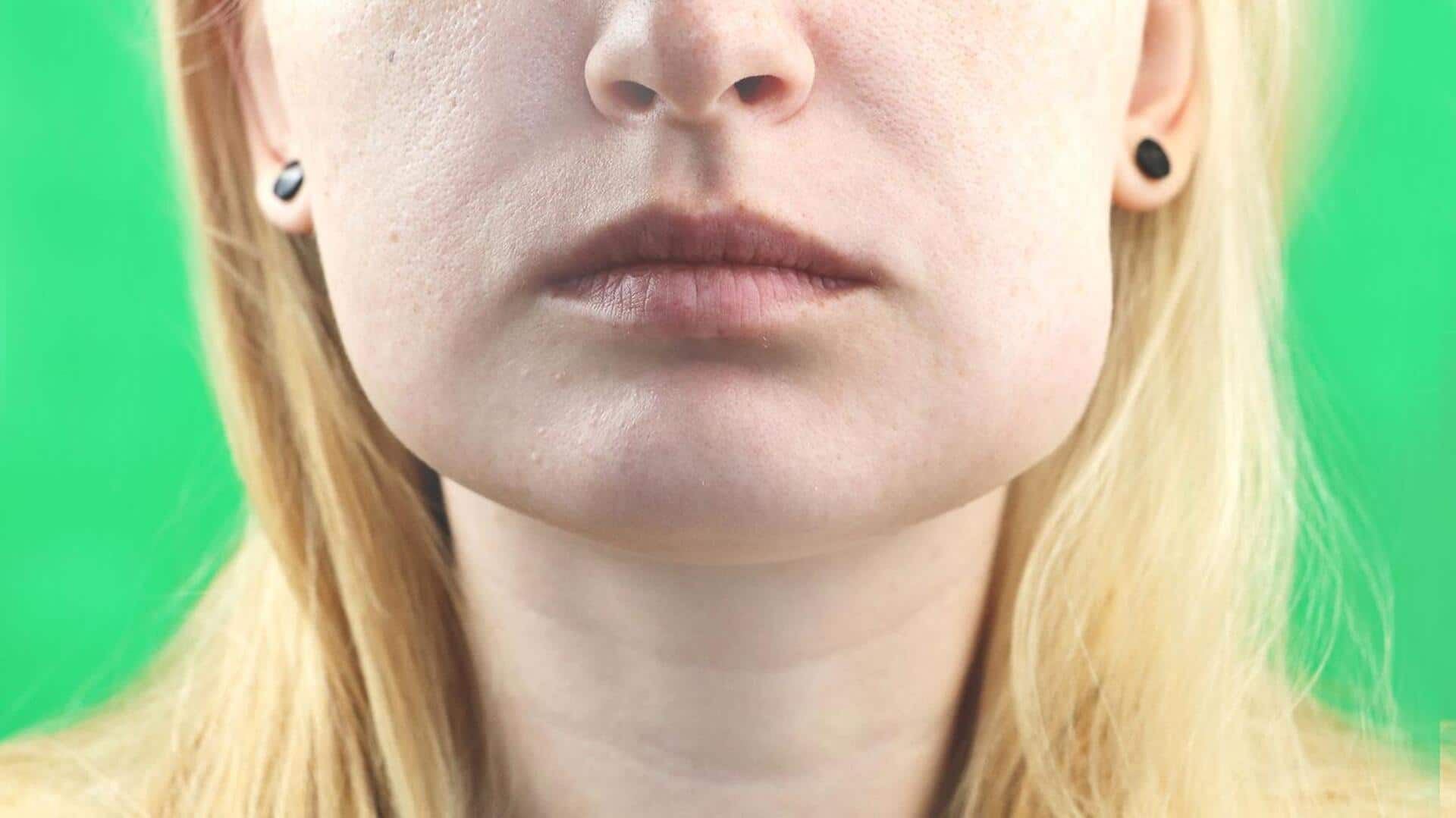 Swelling on the cheek? These natural remedies may help